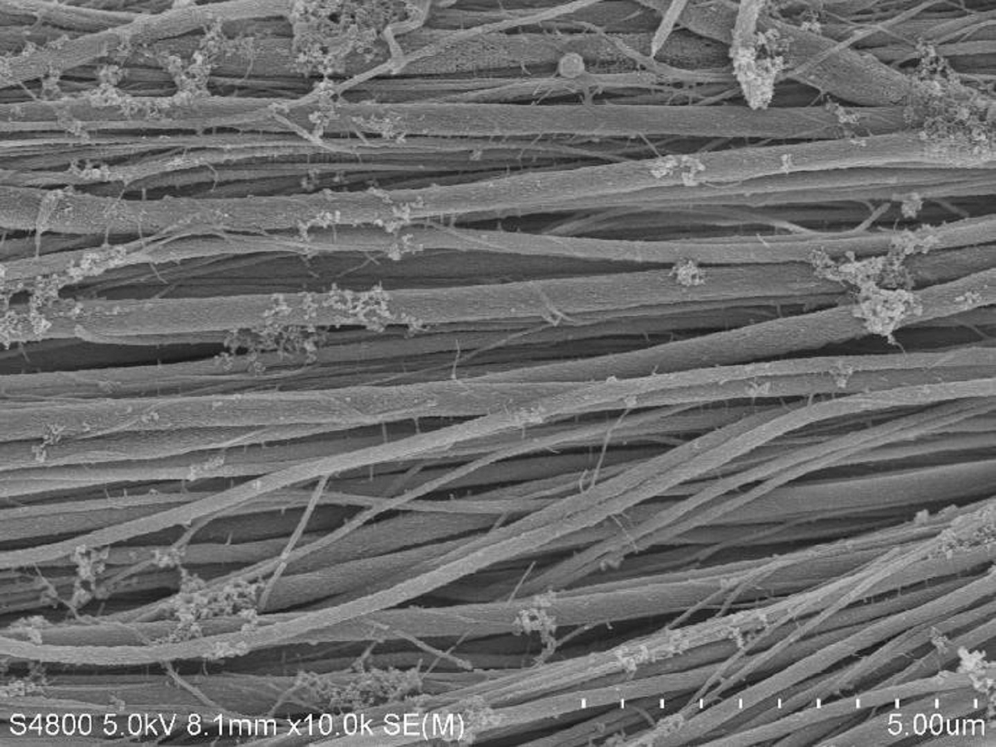 Kollagenfaserbündel nach der Mineralisation mit dem Knochenmineral Kalziumphosphat unter dem Elektronenmikroskop